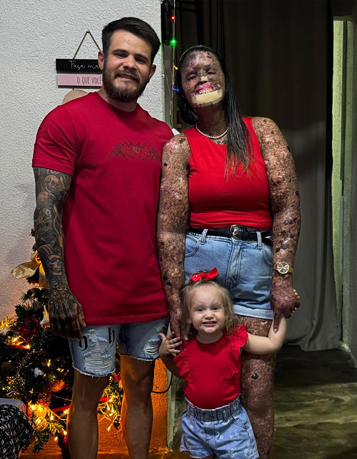 Mom with rare skin condition standing with family in casual red and denim outfits inside a decorated home.