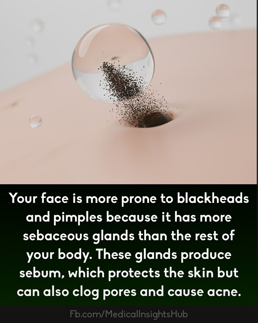 Close-up of a skin pore clogged with blackheads illustrating medical facts about fingers containing no muscles and skin anatomy.