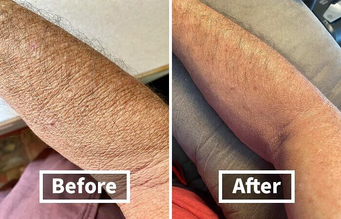 Before and after comparison of skin hydration improvement shown on a forearm from Prime Day 2024 best-sellers.