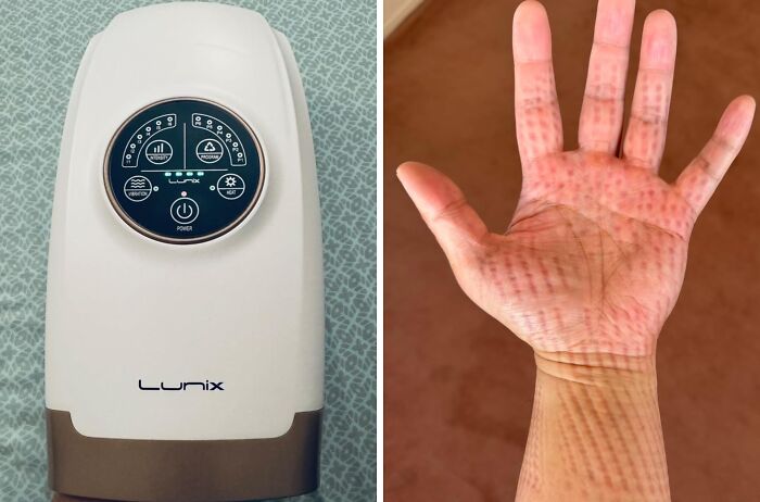 Hand with red marks next to a Lunix device, illustrating low-effort, high-reward life hacks for easy health and wellness benefits.