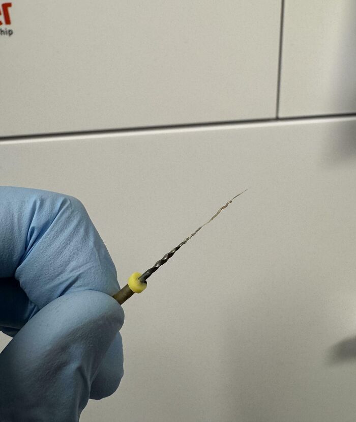 Gloved hand holding a twisted, thin object resembling a bizarre and fascinating photo of the human body detail.