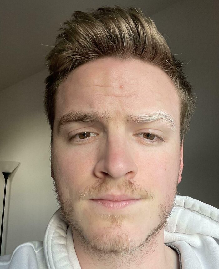 Joven con tono de piel natural y cabello rubio oscuro, mostrando detalles curiosos del cuerpo humano en primer plano.