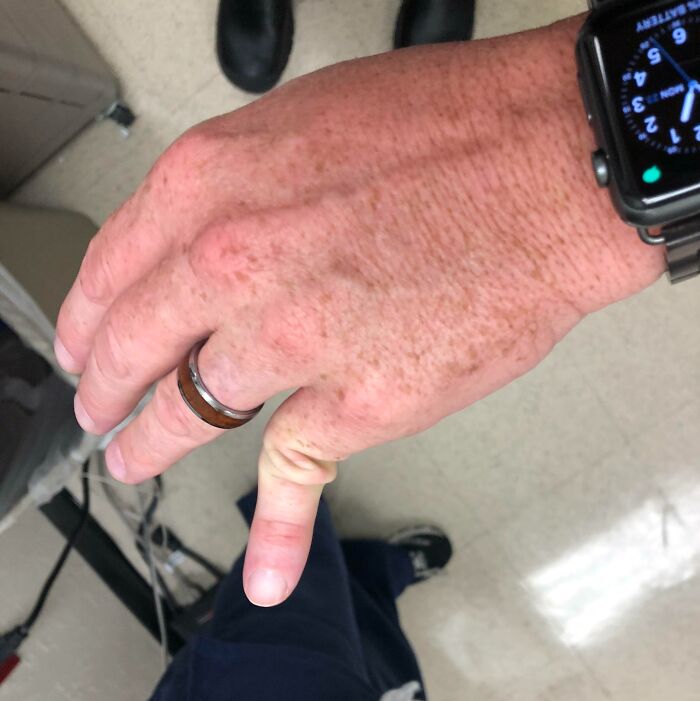 Close-up of human hand with visible skin texture and watch, showcasing unique features of the human body.