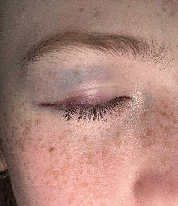 Close-up photo of a human eye with closed eyelid, freckles, and natural skin texture showing bizarre details of the human body.