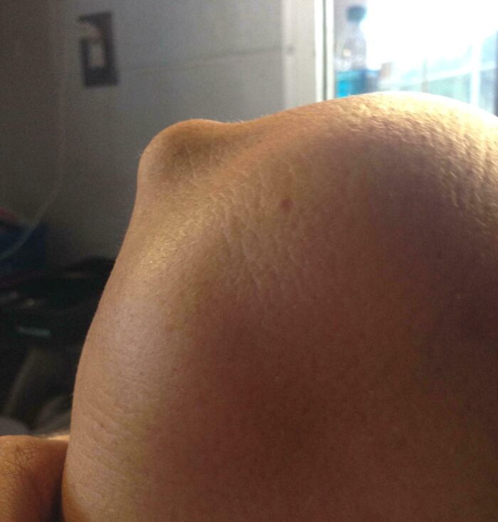 Close-up photo of a bizarre and fascinating human body feature showing unusual skin texture and shape.