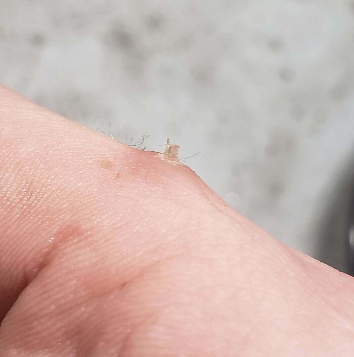 Close-up of a human finger with a tiny transparent skin fragment attached, showcasing bizarre and fascinating human body details.