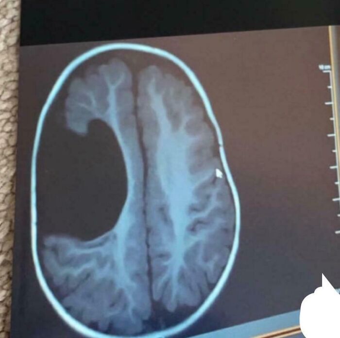 Radiografía cerebral que muestra una imagen curiosa e interesante del cuerpo humano con sección visible del cerebro.