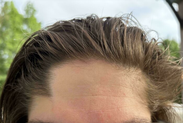 Close-up of human forehead and hairline showcasing natural skin texture in a bizarre and fascinating human body photo.
