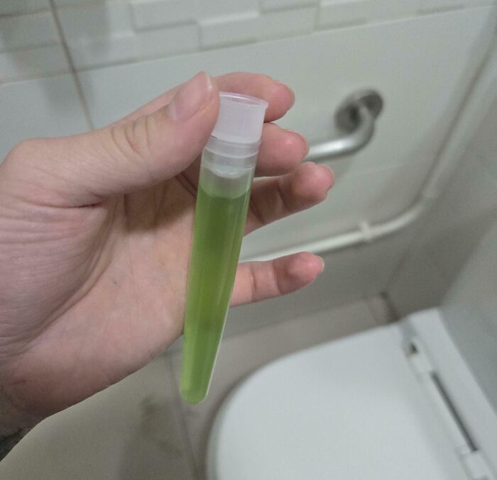 Mano sosteniendo tubo con líquido verde, detalle curioso para imágenes del cuerpo humano y sus secretos.