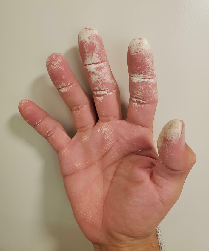 Close-up of a human hand with powdery white residue on fingers, showcasing bizarre and fascinating aspects of the human body.