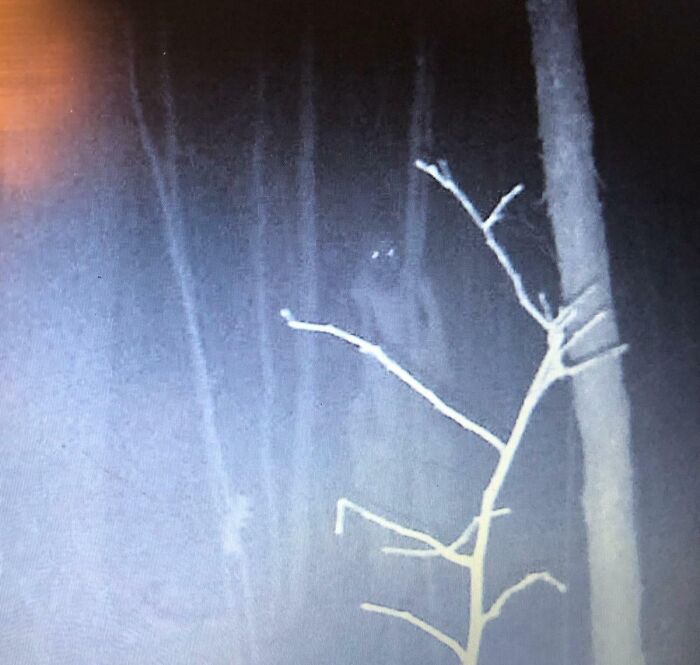 Shadowy figure with glowing eyes in a dark forest at night, evoking chilling ghost encounters and eerie atmosphere.