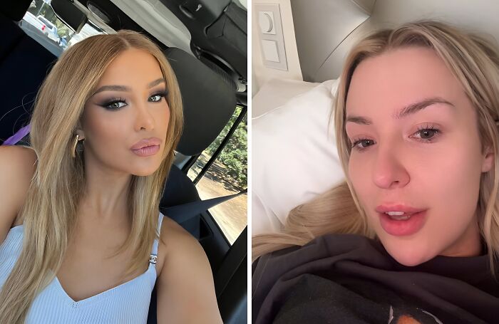 Side-by-side images of a celebrity with makeup and the same celebrity makeup-less showing natural look behind the scenes