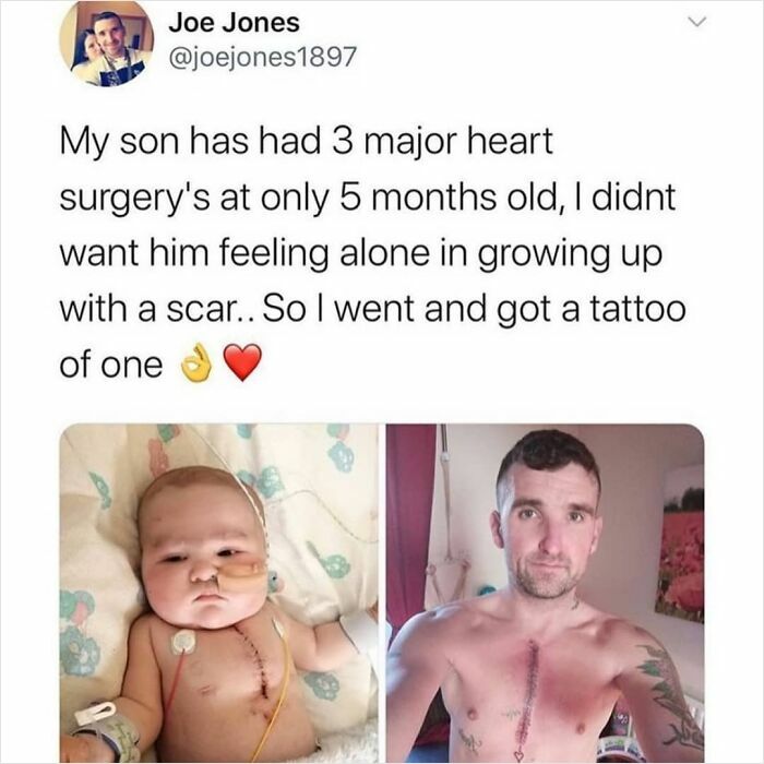 Father with heart surgery scar tattoo matching his son’s scar, sharing a feel-good post to restore faith in humanity.