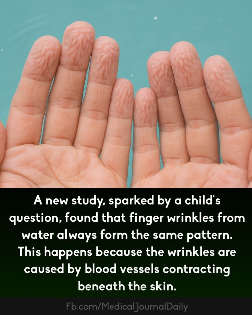 Wrinkled fingers shown after water exposure, illustrating that fingers contain no muscles and skin reacts to blood vessel contraction.