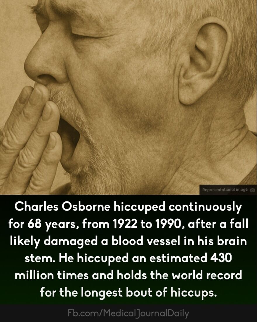 Elderly man covering mouth yawning, illustrating curious medical facts about fingers containing no muscles.