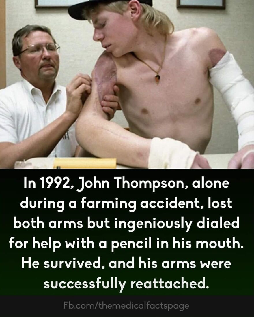 Medical professional examining young man’s reattached arms after a farming accident, illustrating curious medical facts.