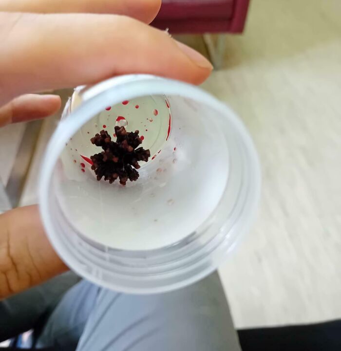 Hand holding plastic container showing object inside that looks unusual, an interesting thing requiring a double take to realize.