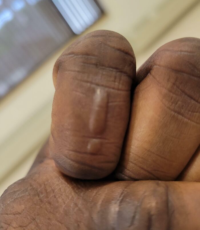 Close-up of fingers showing unique ridges and creases, an interesting thing that required a double take to realize what it really was.