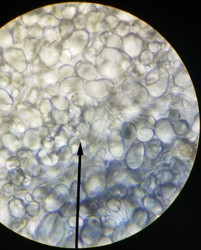 Microscopic image showing detailed cellular structures and bubbles giving a cool perspective of ordinary things.