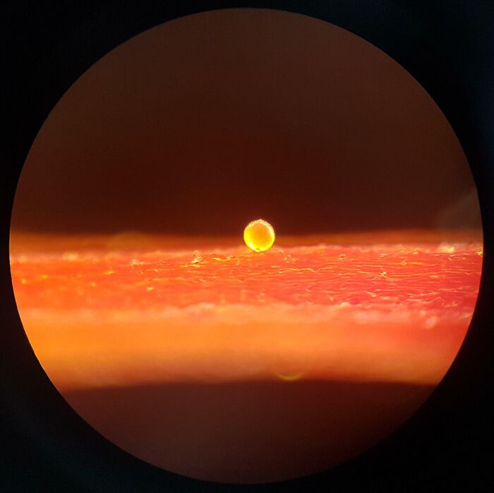 Microscopic image showing a tiny spherical object on a textured orange surface, highlighting cool microscopic details.