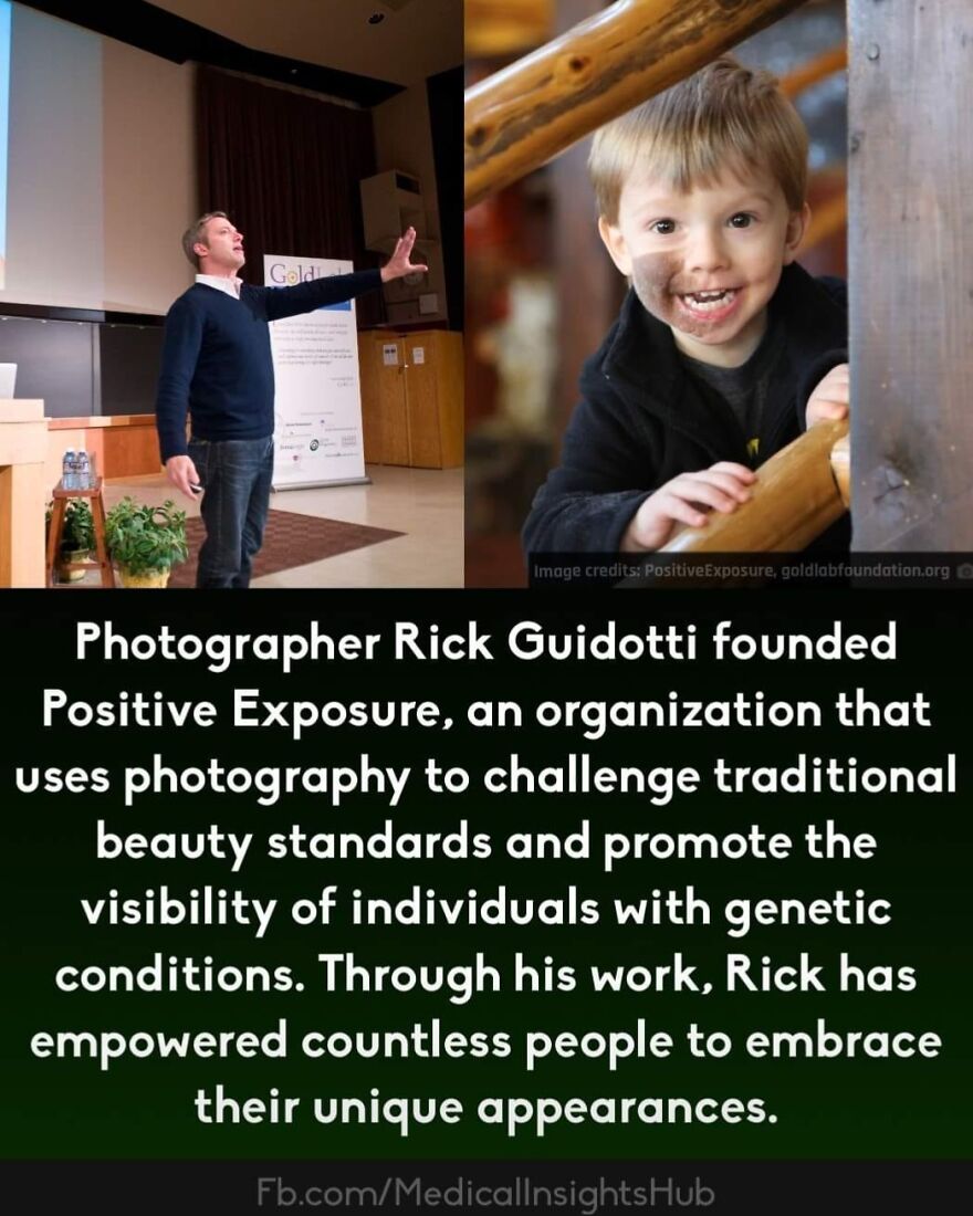 Photographer Rick Guidotti speaking about genetics and unique appearances in a presentation promoting medical facts on fingers.