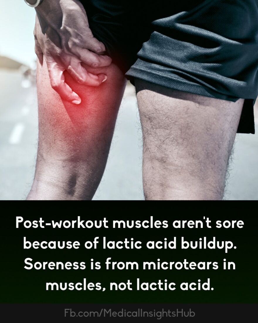 Man holding sore thigh muscle after workout, illustrating muscle soreness and medical facts about muscles.
