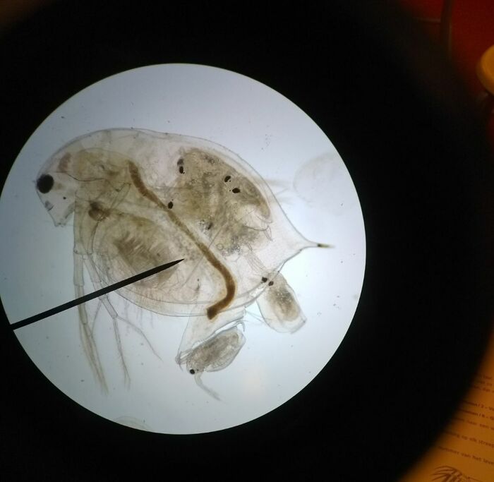 Microscopic image showing the detailed structure of a tiny aquatic organism through a lens for a different perspective.