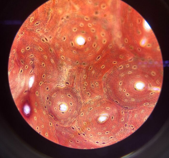 Close-up microscopic image showing detailed cellular structure with red and orange hues, highlighting cool microscopic patterns.