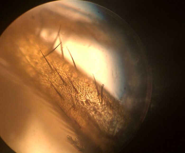 Microscopic image showing close-up details of hair and skin texture with sharp hair follicles in warm lighting.