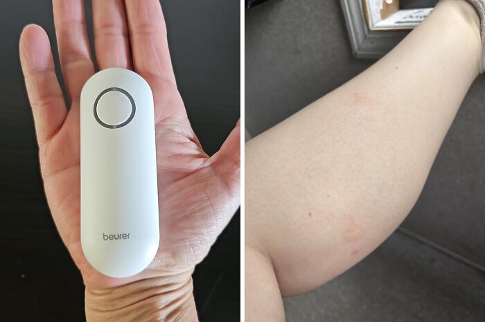 Hand holding a chemical-free beauty device next to a smooth skin arm showcasing chemical-free skincare results.