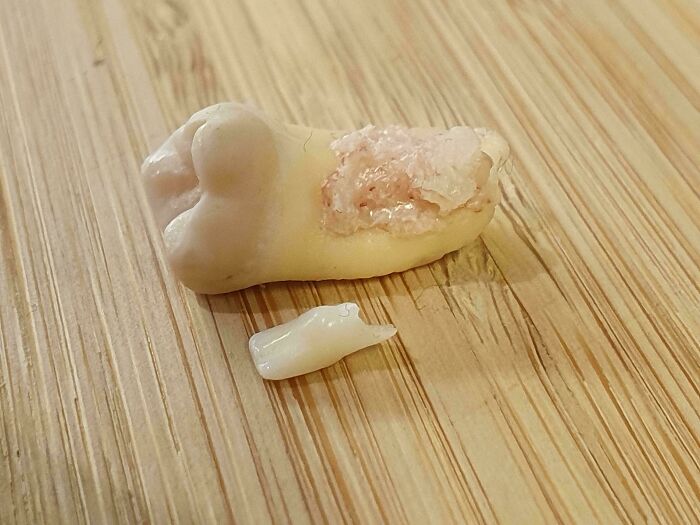 Comparison pic showing a large damaged tooth next to a much smaller healthy tooth on a wooden surface.