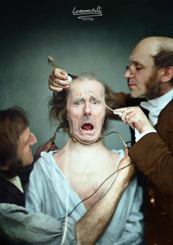 Colorized history pic of a man in distress undergoing an old medical procedure with two men assisting him.