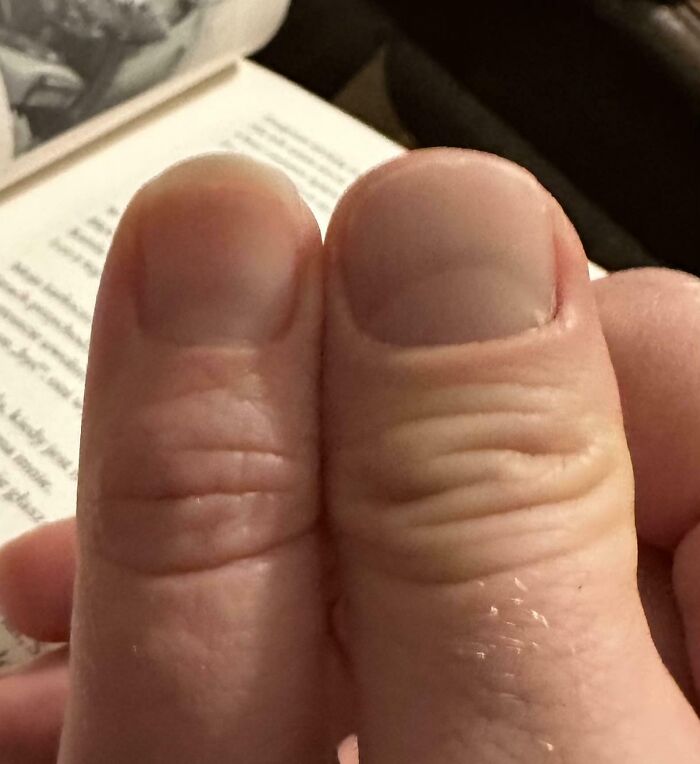 Close-up comparison of two thumbs showing natural variety and differences in skin texture and nail shape.