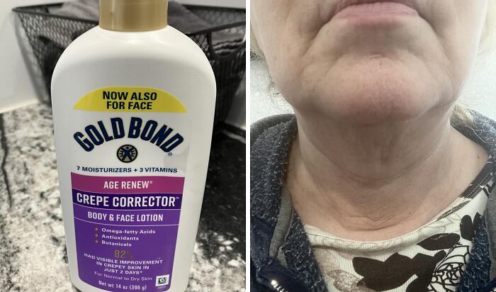 Gold Bond Age Renew Crepe Corrector lotion packaging and application on neck, trending products in the Pandaverse virtual market.