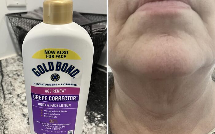 Gold Bond Age Renew Crepe Corrector lotion next to a close-up of a person's chin showing skin texture improvement.