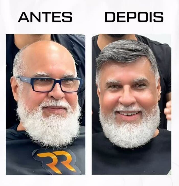 Older man before and after Brazilian stylist helps men with baldness, showing a natural hair transformation and renewed look.