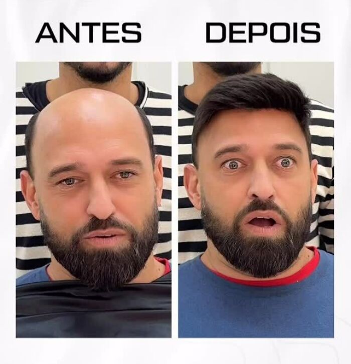 Before and after photos of a man transformed by a Brazilian stylist helping men with baldness look like themselves again.