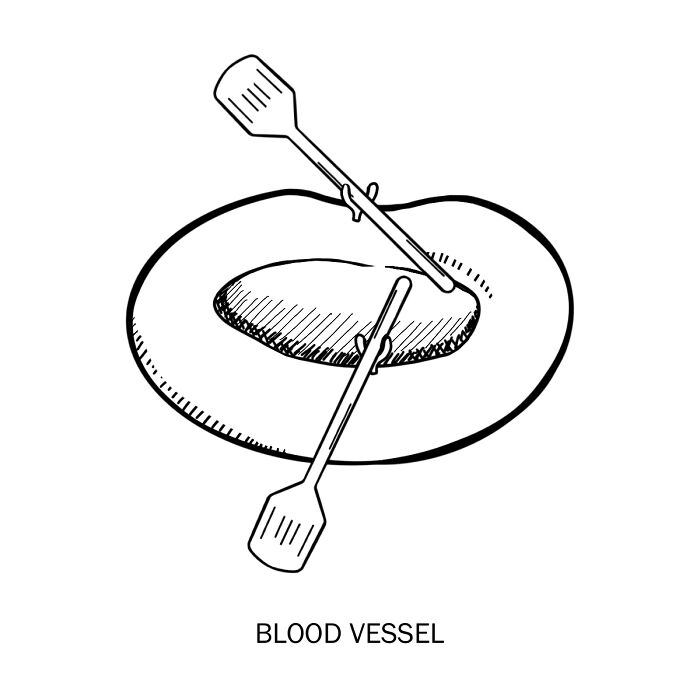 Illustration of clever drawings using wordplay showing a blood vessel as a boat with oars in black and white.