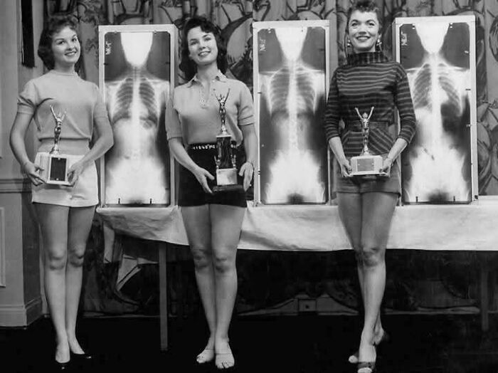 Three women in vintage outfits holding trophies stand in front of large X-ray images, showing ridiculous pics from the past.