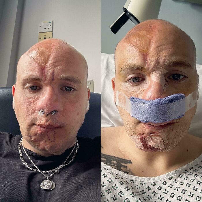 Close-up views of a man’s facial injuries and medical bandages showcasing gory and interesting medical cases.