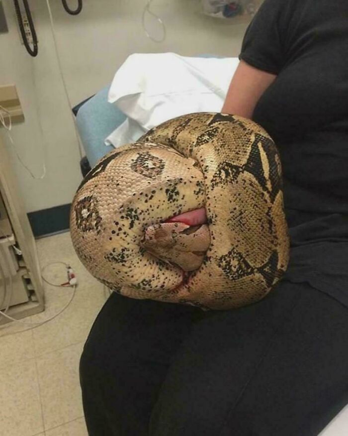 Large constrictor snake tightly coiled around a person's arm in a medical setting, illustrating a gory medical case.