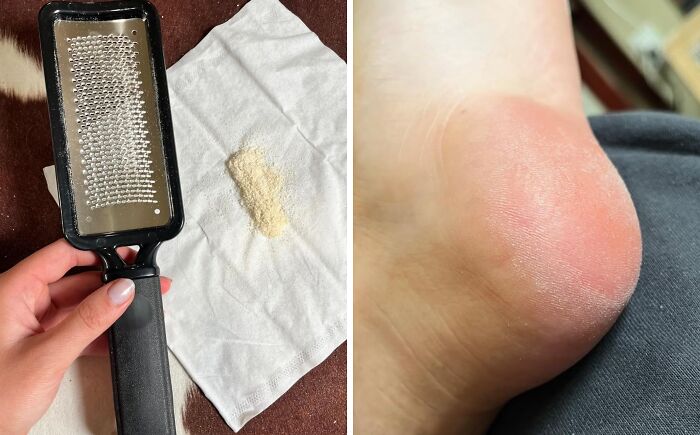 Foot care tool removing dry skin flakes from heel, illustrating one of the genius ways to fix little glitches.