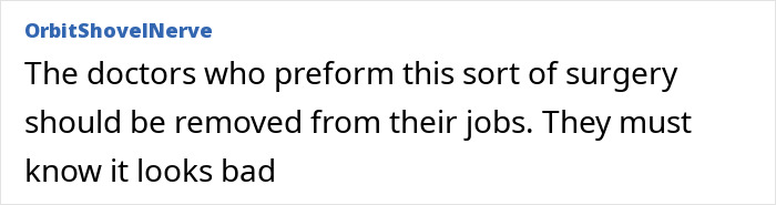 Comment stating doctors performing BBL surgery should lose their jobs due to serious concerns about patient safety and outcomes.