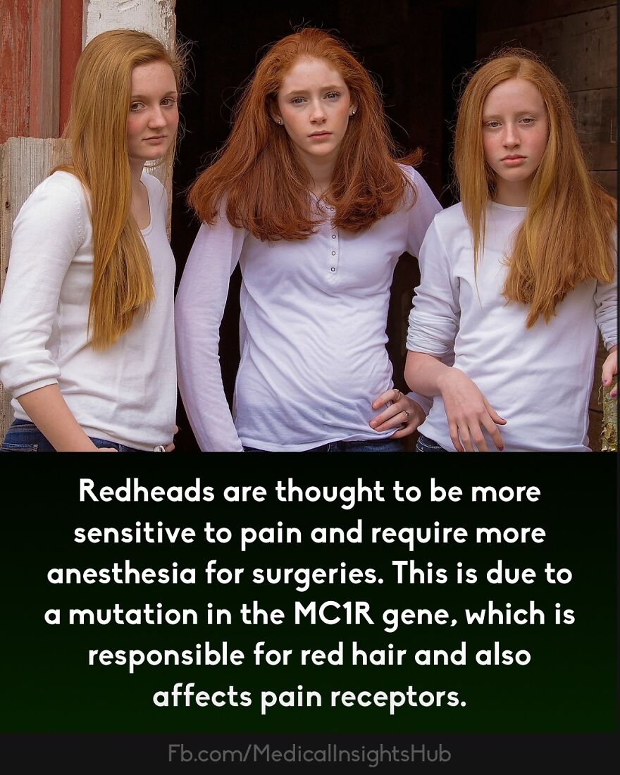 Three redheaded young women in white shirts, illustrating curious medical facts about fingers containing no muscles.