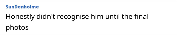 Kevin Spacey at red carpet event, sparking plastic surgery rumors after receiving an award.