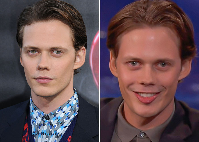 Actor masculindo mostrando peculiaridades únicas en dos expresiones faciales distintas, destacando celebridades que aceptan sus diferencias.