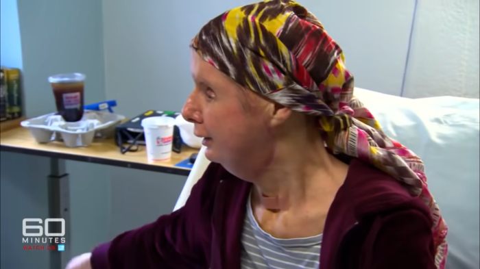 Woman with face transplant 16 years after being attacked by chimpanzee, sitting in a room wearing a colorful headscarf.
