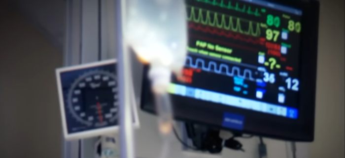 Hospital medical monitor showing vital signs in the background of a woman whose face was torn apart by chimpanzee case.