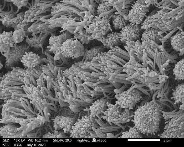 Microscopic image showing detailed structures resembling tiny hair-like and clustered formations at 4500x magnification.
