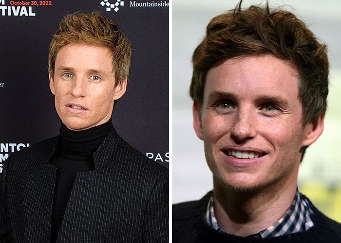 Actor masculino con peculiaridades únicas sonriendo en dos fotos, destacando celebridades que aceptan sus diferencias.